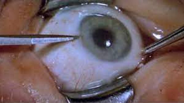 La 'Angustia' de Bigas Luna tendrá un remake 1 La 'Angustia' de Bigas Luna tendrá un remake 1