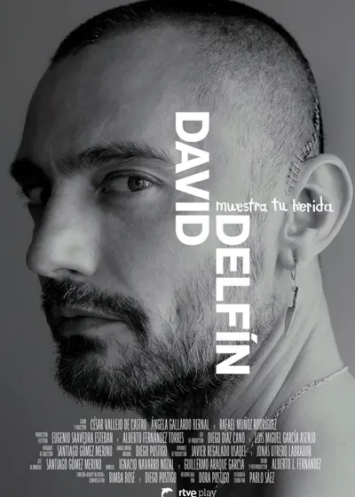 DAVID DELFÍN. MUESTRA TU HERIDA 1 DAVID DELFÍN. MUESTRA TU HERIDA 1
